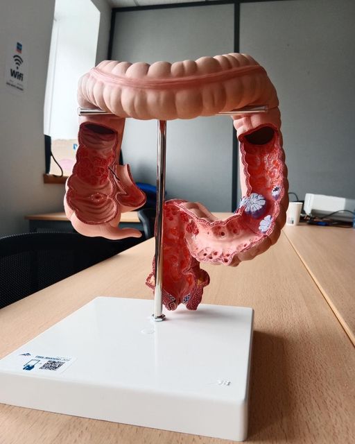 maquette colon
