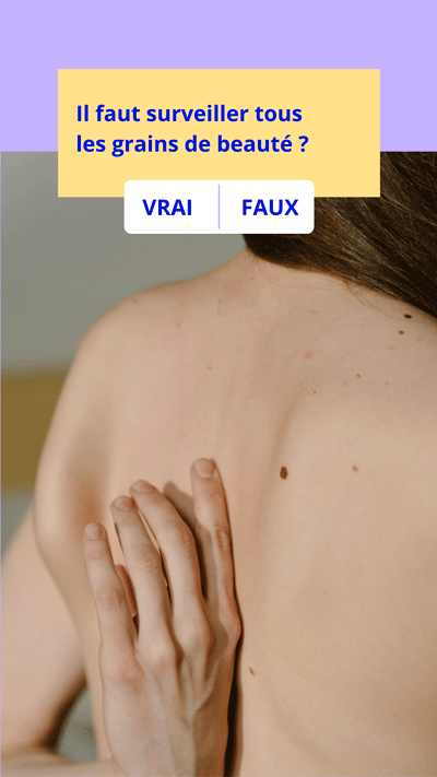 surveiller grain beauté