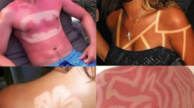 le sunburn art est une mauvaise idée